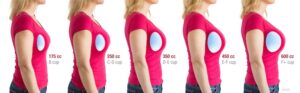 women in red shirt, duplicated to illustrate different sizes of breast implants.