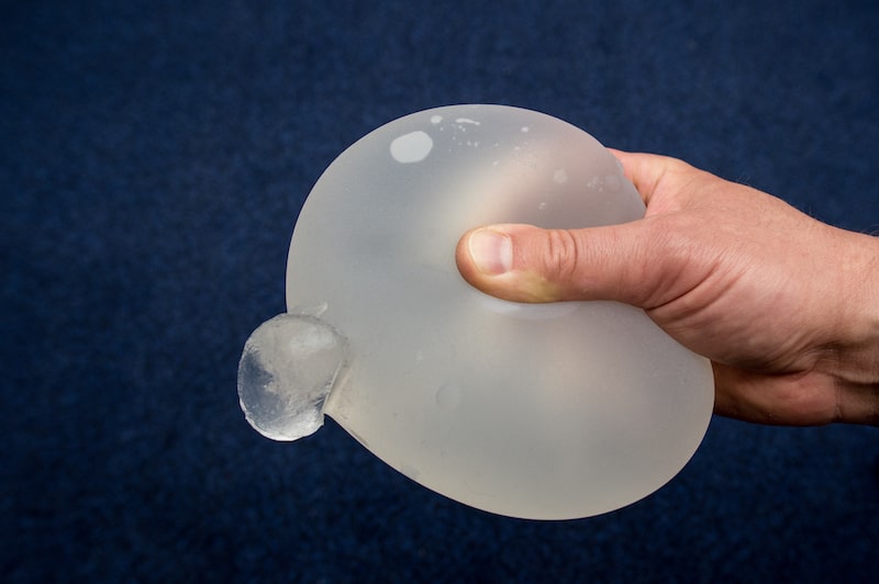 hand holding a ruptured breast implant.
